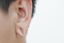 The torn skin edges are excised and the fresh edges are stitched together with sutures that need to remain in place for one or two weeks depending on the clinical situation. Earlobe Repair In Btm Layout Bengaluru Id 14822161648