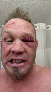 Rocky "Rock Monster" Johnson