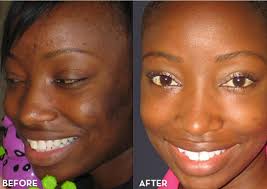 Pin On Health And Beauty