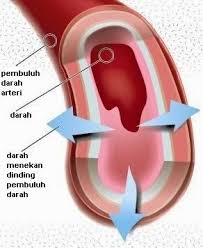 9 Jenis Obat Tekanan Darah Tinggi Hipertensi Tekanan Darah Darah Penekanan