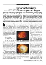 Maybe you would like to learn more about one of these? Immunpathologische Erkrankungen Des Auges