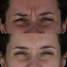 Cosmetic Dentistry in Marrero