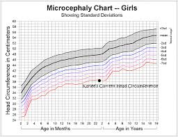 microcephaly head circumference chart head circumference