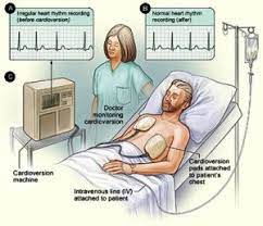 Maintain a healthy weight 5. Electrical Cardioversion In Annapolis Md Chesapeake Cardiac Care