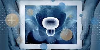 Adenocarcinoma cancers being usually in one of the following organs: Testing For Prostate Cancer In Primary Care Bpacnz Report