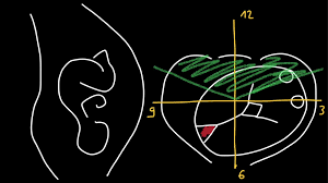 Image result for Manual Rotation in Occipitoposterior Presentation