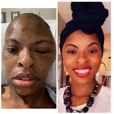 Ya-Hwei Cheng, PharmD