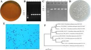 Impact of Clostridium butyricum HADIG-CB003 dietary supplementation on the  gut microbiota of Kunming mice | Applied Microbiology and Biotechnology |  Springer Nature Link