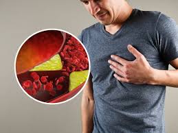 High Cholesterol Management: 10 Tips To Lower High Cholesterol Levels  Naturally | TheHealthSite.com
