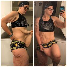Brittany May Lost 336 Pounds But No One Told Her How Painful It Would Be To Live With Loose Skin After W Recipes For Beginners One Person Meals Keto Diet Book
