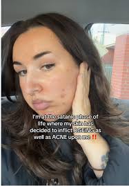 Who can I take this up with???? Very unfair…. #fyp #skincare #acnescarring