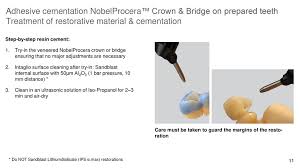 Maybe you would like to learn more about one of these? Nobelprocera Cementation Guide Ppt Download