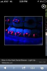Braces Colors Black And Blue Glow In The Dark Braces Braces Colors Getting Braces Cute Braces Colors