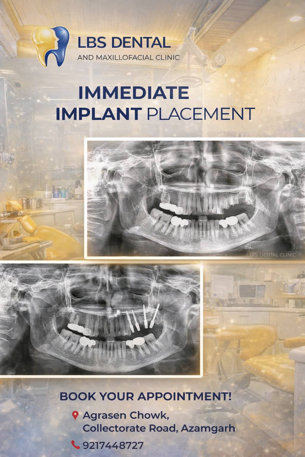 Dental implant