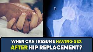 When can I have SEX AFTER Total Hip Replacement Surgery?  #hipreplacementrecovery - YouTube