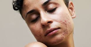 Integrative Naturopathic Medical Centre