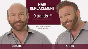 Check spelling or type a new query. Hair Replacement Hair Club