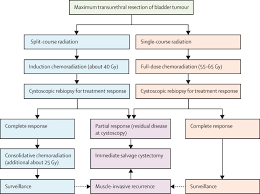 Often, you cannot see blood in your urine without a microscope. Bladder Cancer The Lancet