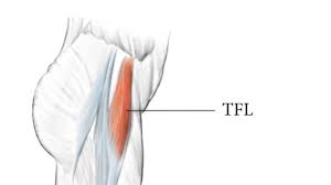 How To Get Rid Of Pain In The Tfl Tensor Fascia Lata