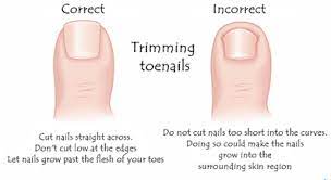 Often you can take care of ingrown toenails on your own. Pin On Beauty Tips