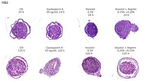 Inositol is generally considered safe in adults. Cosmetics Free Full Text Hair Strengthening Evaluation Of Anisotropic Osmolite Solutions Inositol Arginine Cross Talk Between Dermal Papilla Fibroblast And Keratinocytes Of The Outer Root Sheath Using A Âµhair Follicle 3d
