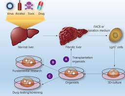 organoids of liver diseases from bench to bedside