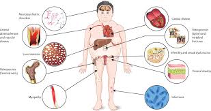 Complications Of Cushing S Syndrome State Of The Art The Lancet Diabetes Endocrinology