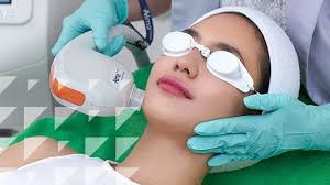 Manfaat Sensasi Treatment Alma Beauty Rejuvenation, Memutihkan Sekaligus  Menyehatkan Kulit Wajah