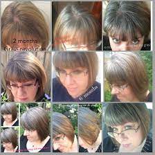 My Gray Hair Grow Out Progress Months 2 Thru 10 Ellendugan Revolutiongray Gray Hair Growing Out Silver Hair Silver Grey Hair