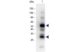 The antibody is conjugated to horseradish peroxidase (hrp) and is commonly used for wb, ihc and elisa. Goat Anti Human Igg Heavy Light Chain Antibody Hrp Abin1043965