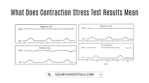 Image result for Contraction Stress Test