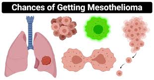 Angiogenesis makes new blood vessels that connect to the growing tumor and provide it with blood and nutrients. Mesothelioma And Chances Of Getting Mesothelioma