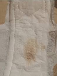 Pilula do dia seguinte | BabyCenter