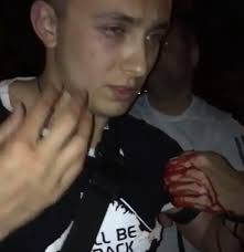 Сам стерненко разместил фотографии, на которых радикалы выбрасывают в мусорный бак цветы те, кто поддерживает киев, делают это зажмурившись, а остальные просто стараются. A Bylo Li Napadenie Na Pravoseka Sternenko Ukrainskaya Zhurnalistka Analiziruet Rezonansnoe Ubijstvo V Odesse