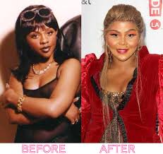 Top 10 Most Botched Celebrity Plastic Surgery Jobs Plastic Surgery Gone Wrong Naturally Beautiful Women Plastic Surgery