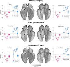 10,000 social brains: Sex differentiation in human brain anatomy | Science  Advances