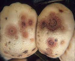 Epicoccum Nigrum Wikipedia Clean Air Fungi Allergies