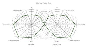 29 eye catching field of vision chart