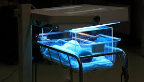 Neonatal gulsott, forårsaket av hyperbilirubinemi, ses ofte hos friske nyfødte. Gulsott Hos Nyfodte Nhi No