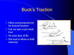 Cranial tongs, thomas splints with peason attachments, 90 degrees to 90 degrees. Ppt Orthopaedic Traction Powerpoint Presentation Free Download Id 210938