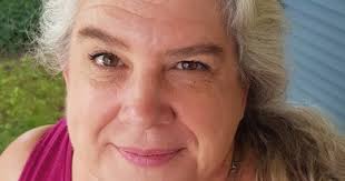 Wasp Sting and 5 Tips for Dealing Them