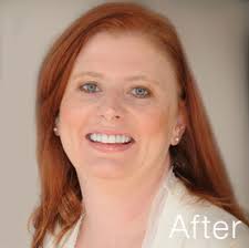 Grand Rapids Dentist Dr. Randall Chambers Satisfied Patients Before and  After