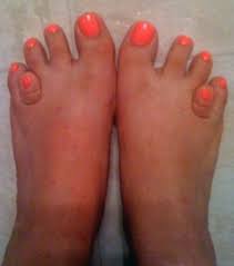 Ver más ideas sobre imagenes de uñas acrilicas, uñas acrílicas, uñas. El Ranking De Los Pies Mas Feo Del Mundo Que Hara Que Se Te Quiten Todos Tus Complejos