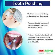 Pin On Dental Information