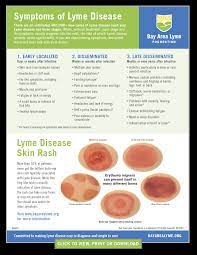 Lyme Disease Symptoms Bay Area Lyme Foundation