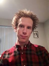 has anyone drank before surgery?