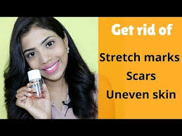 Bio Oil For Stretch Marks Review India Pin On Beauty Youtube