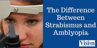 Image result for Amblyopia