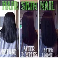 Biotin Pills Hair Growth Results Before And After Some More Results From The Skin Hair And Nails Supplements Hair Skin Nails Supplement Natural Hair Styles Natural Hair Growth