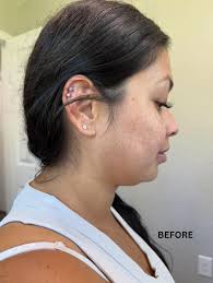 Bartow Chiropractic Care Now Open